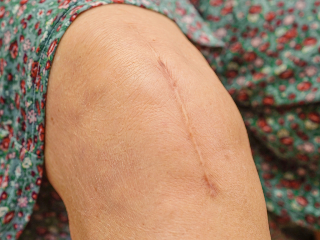 Skletorisch litteken